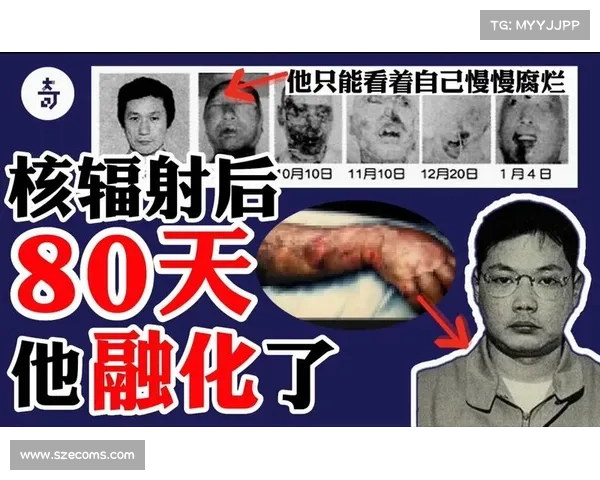 辐射对人体部位的攻击:揭秘致命威胁 辐射对人体部位的攻击:揭秘致命威胁